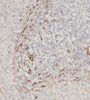 MRPS15 Rabbit Polyclonal Antibody