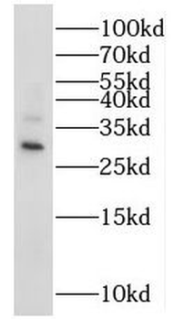 MRPS18B Rabbit Polyclonal Antibody