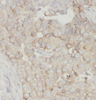 MRPS18B Rabbit Polyclonal Antibody
