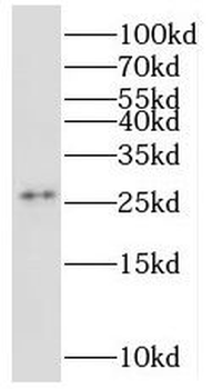 MRPS34 Rabbit Polyclonal Antibody