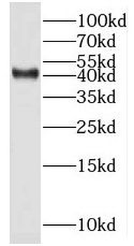 MRPS5 Rabbit Polyclonal Antibody