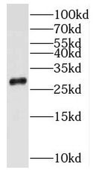 MRRF Rabbit Polyclonal Antibody