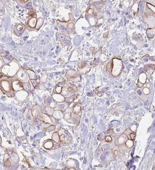 MRRF Rabbit Polyclonal Antibody