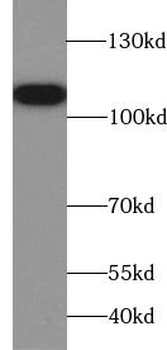 MSH2 Antibody