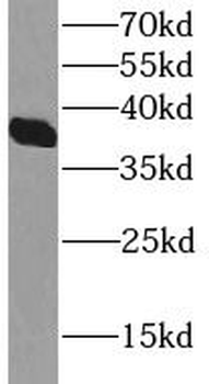 MSI2 Rabbit Polyclonal Antibody
