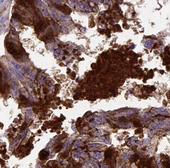 MSI2 Rabbit Polyclonal Antibody