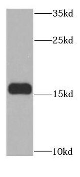 MSRB2 Rabbit Polyclonal Antibody