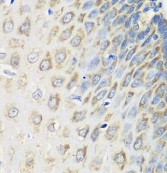 MSRB2 Rabbit Polyclonal Antibody