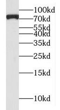 MTA2 Rabbit Polyclonal Antibody