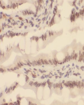MTA2 Rabbit Polyclonal Antibody