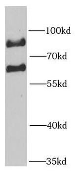 MTA3 Antibody