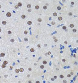 MTA3 Antibody