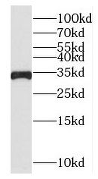 MTCH2 Antibody