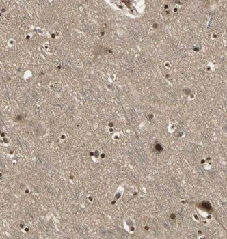 MTPN Rabbit Polyclonal Antibody