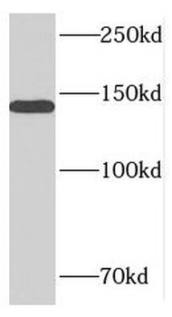 MTR Rabbit Polyclonal Antibody
