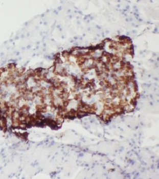 MTR Rabbit Polyclonal Antibody