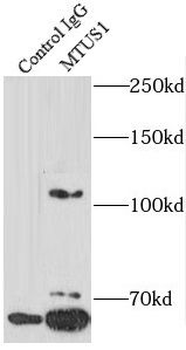 MTUS1 Antibody