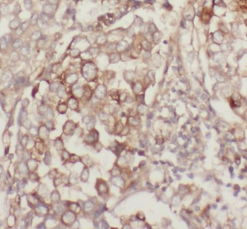 MUC1 Antibody