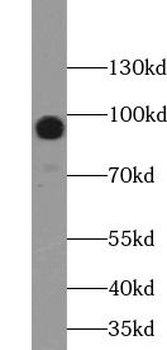 MUC16 Antibody