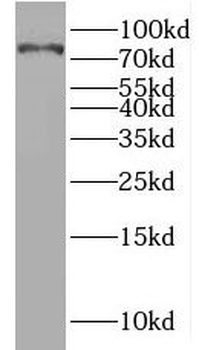 MCOLN3 Rabbit Polyclonal Antibody