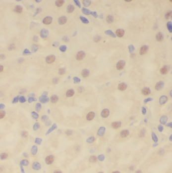 MUS81 Rabbit Polyclonal Antibody