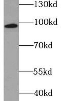 MUSK Rabbit Polyclonal Antibody
