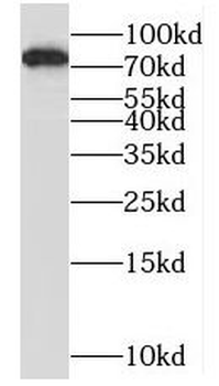 MMUT Rabbit Polyclonal Antibody