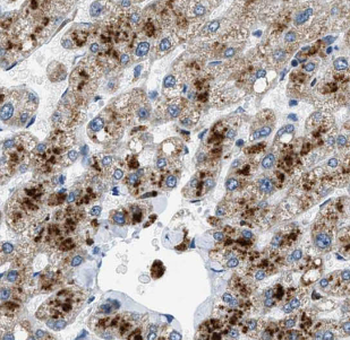 MMUT Rabbit Polyclonal Antibody