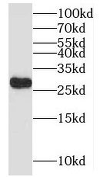 MYCT1 Antibody