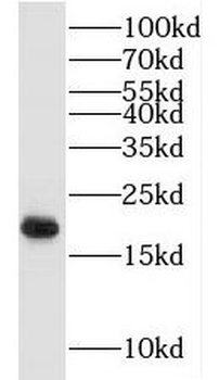 MYL2 Rabbit Polyclonal Antibody