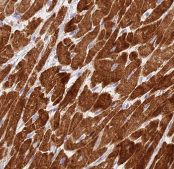 MYL2 Rabbit Polyclonal Antibody