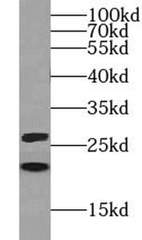 MYL3 Rabbit Polyclonal Antibody