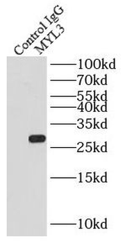 MYL3 Rabbit Polyclonal Antibody