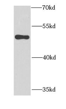 MYLIP Rabbit Polyclonal Antibody