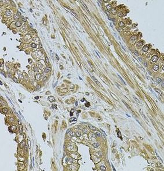 MYLIP Rabbit Polyclonal Antibody