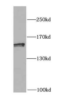 MYLK Rabbit Polyclonal Antibody