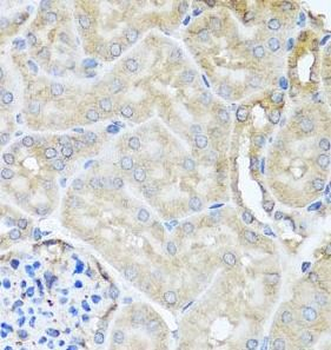 MYLK Rabbit Polyclonal Antibody