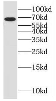 MYOC Rabbit Polyclonal Antibody