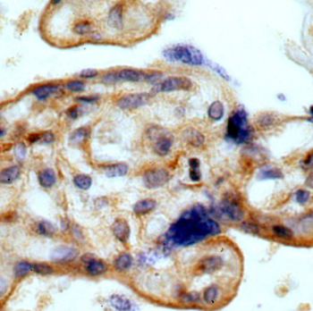 MYOF Rabbit Polyclonal Antibody