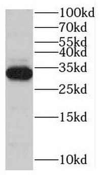 MYOZ1 Rabbit Polyclonal Antibody
