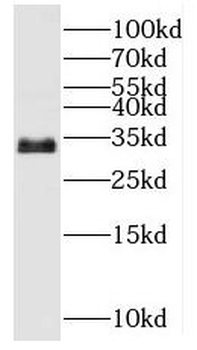 MYOZ2 Antibody