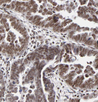 KAT7 Rabbit Polyclonal Antibody