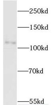 MYT1L Rabbit Polyclonal Antibody