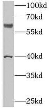 N4BP3 Rabbit Polyclonal Antibody