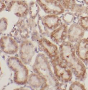 N4BP3 Rabbit Polyclonal Antibody