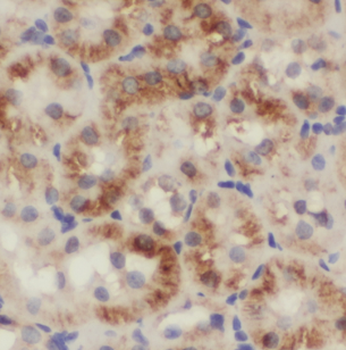 NARS2 Rabbit Polyclonal Antibody