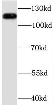 NAT10 Rabbit Polyclonal Antibody