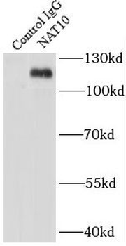 NAT10 Rabbit Polyclonal Antibody