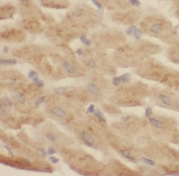 CDH2 Mouse Monoclonal Antibody