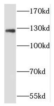 NCAM2 Rabbit Polyclonal Antibody
